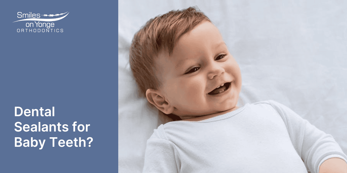 Dental Sealants for Baby Teeth?